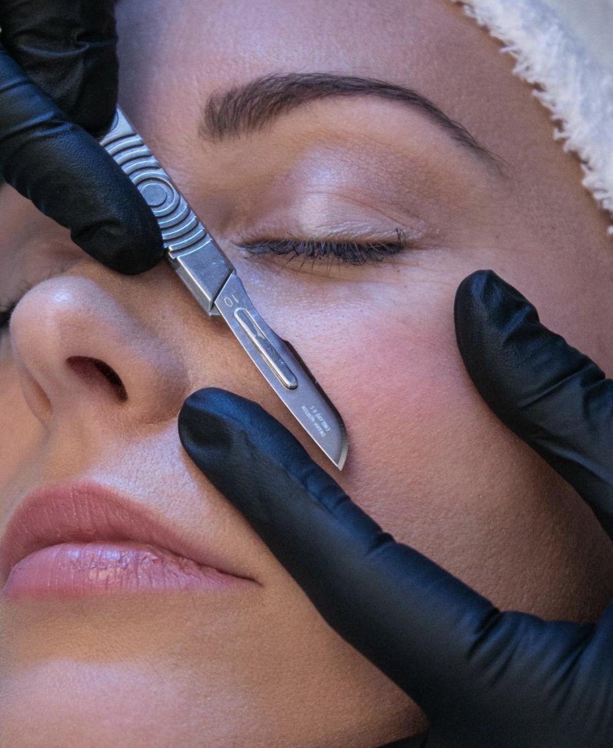 Dermaplaning at Skin by Saif Clinic